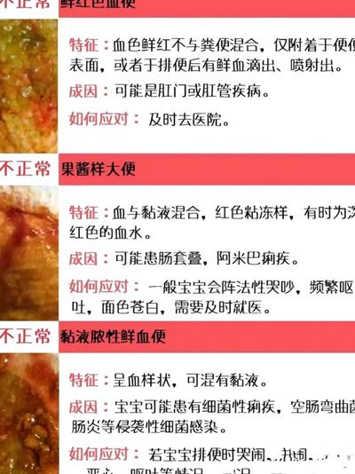 便便卡使用指南